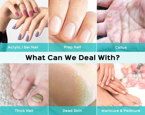 Nail care solutions for acrylic, gel, and thick nails, dead skin, and callus removal img