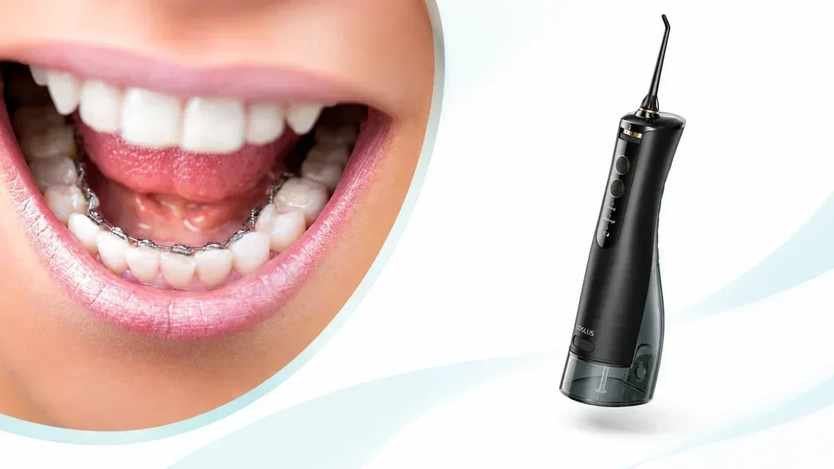 How to Clean Lingual Braces