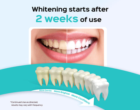 W40 Whitening water flosser img