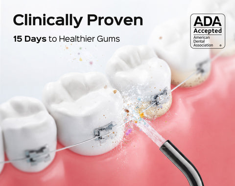 E40 Water flosser cleaning around braces and along the gumline img