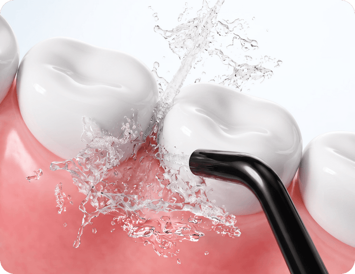 Interdental plaque removal